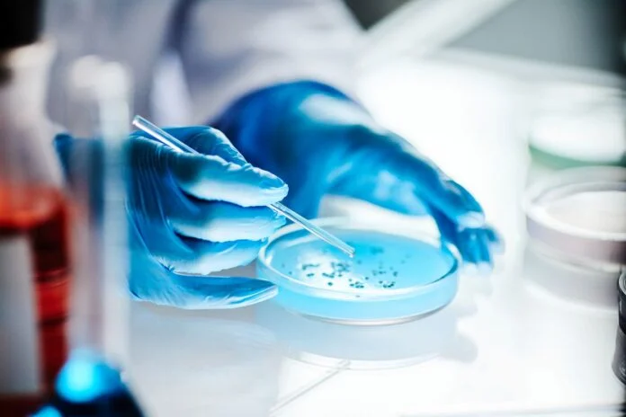 Astorg completes acquisition of Microbiology business from Thermo Fisher Scientific, establishing an independent global diagnostics specialist