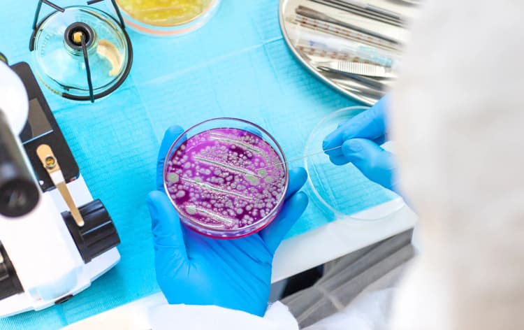 Astorg to acquire global microbiology business from Thermo Fisher Scientific