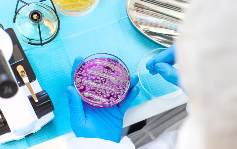 Astorg to acquire global microbiology business from Thermo Fisher Scientific