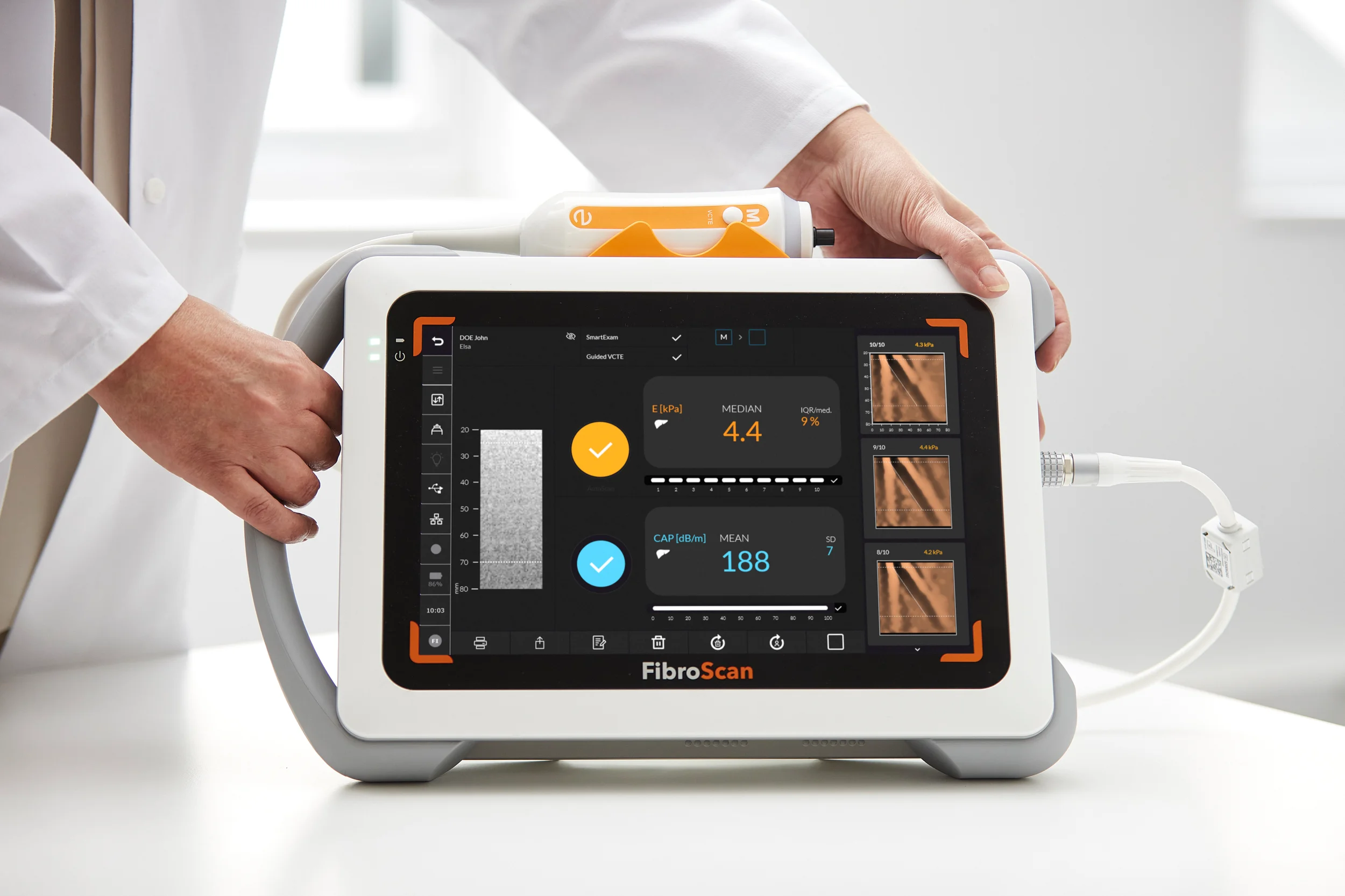 Echosens Mini 430 In Situ 1 Rvb Hr
