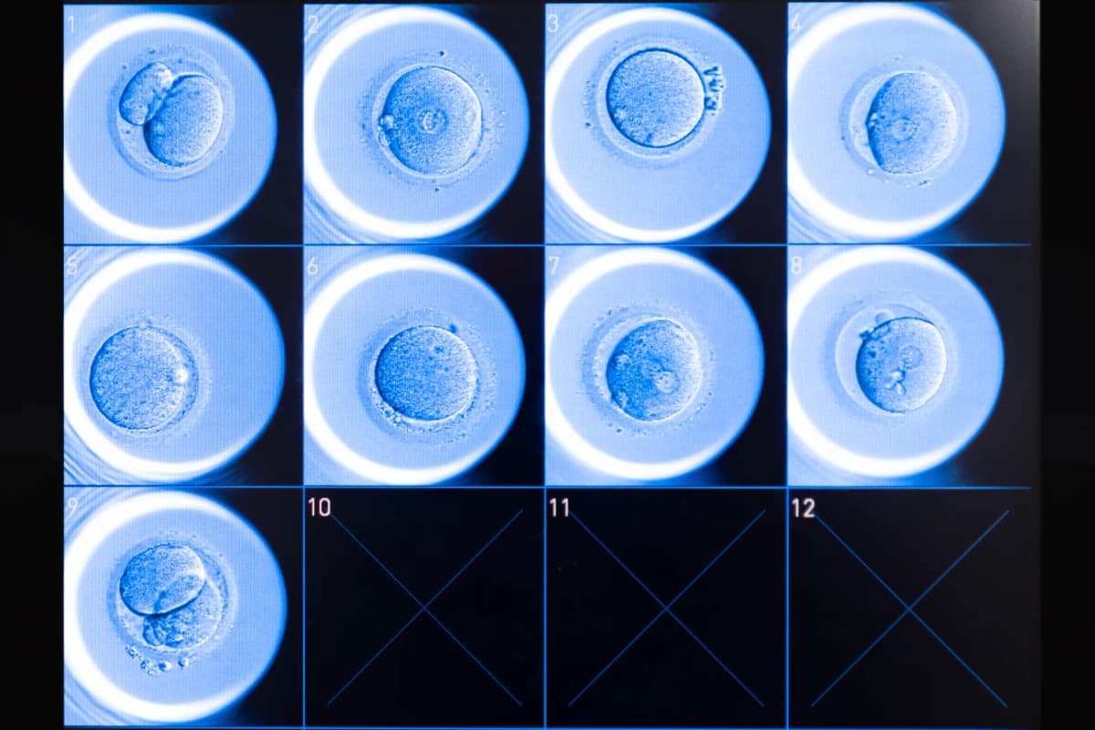Astorg continues to bolster its newly combined global leader in assisted reproductive technology by acquiring FUJIFILM Irvine Scientific’s medical media business